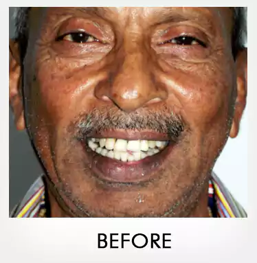 ganesan-iyapillay-before