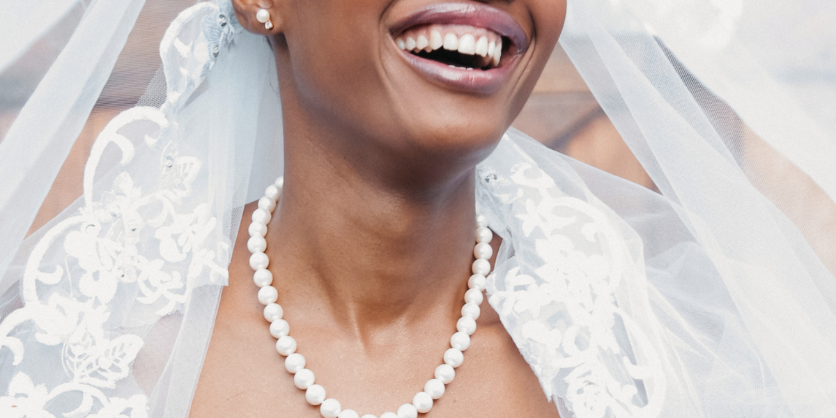 perfect smile for wedding season