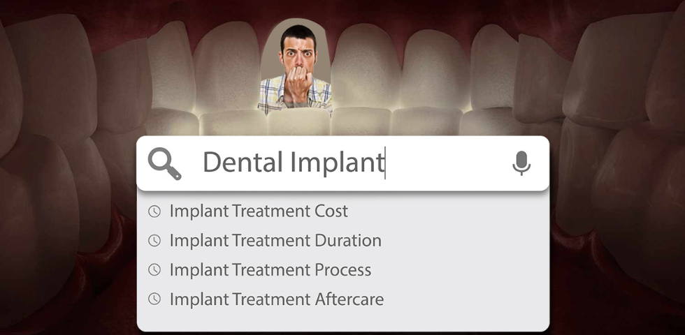 Implant Treatment Guide