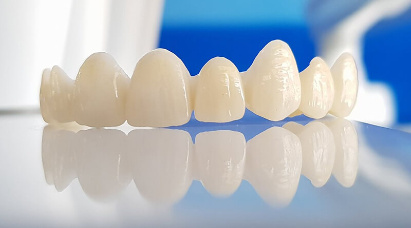 everything about zirconia dental crowns