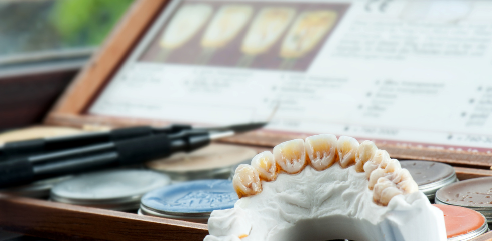 Confused About Dental Crowns And Bridges - We Have The Info!