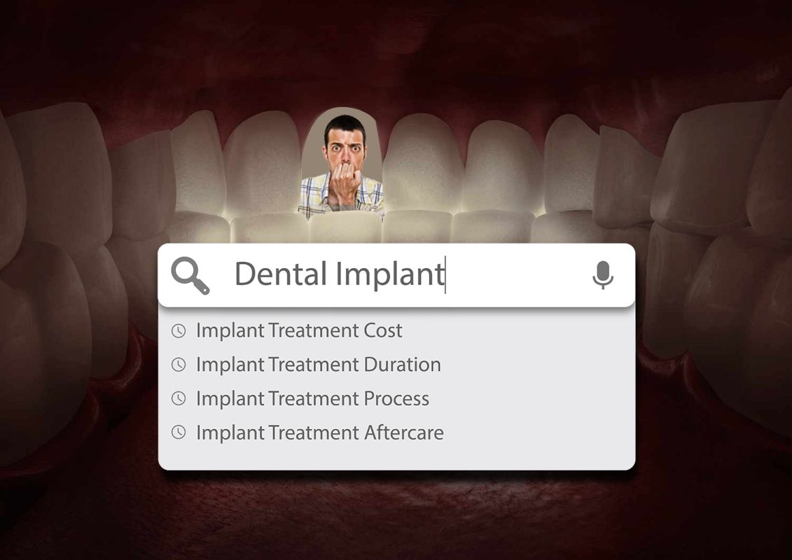 Implant Treatment Guide