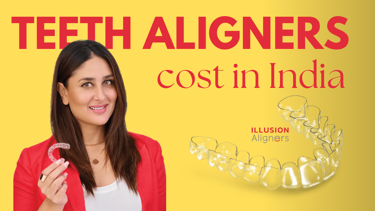 aligners cost in India
